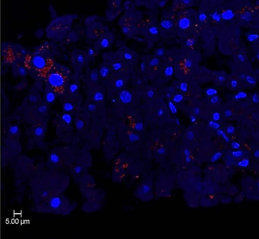 Groundbreaking Research on Liver Disease and Microplastics Begins